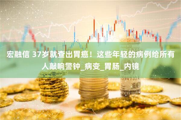 宏融信 37岁就查出胃癌！这些年轻的病例给所有人敲响警钟_病变_胃肠_内镜